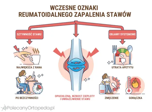 Guzki reumatoidalne - Czy to RZS? Rozpoznaj i działaj!