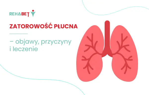 Zatorowość płucna - objawy, diagnostyka i leczenie